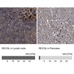 RECQ1 Antibody, Novus Biologicals 0.1mL; Unlabeled:Antibodies, Polyclonal
